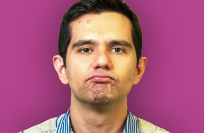 persion with a chin raise expression